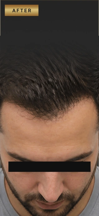 After